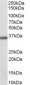 Goat Anti-AKR1C3 Antibody
